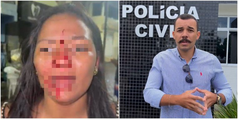 Candidato a vereador e namorada são acusados de agredir mulheres no interior da Bahia